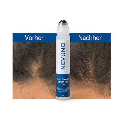 ScalpRoll | Pflege-Essenz für gesunde Haarwurzeln